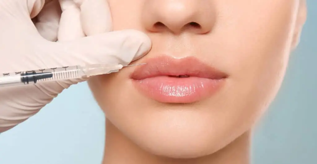 Book Services 5 fillers treatment