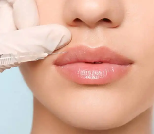 All Services 7 Anti Wrinkle And Dermal Fillers